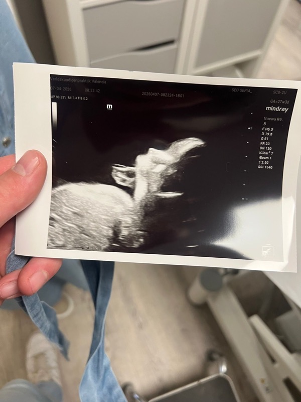 Echo-afbeelding van de baby